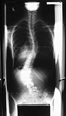 Spine Surgery 2000 Practice Questions: Set 1 (Solved) - Figure 10