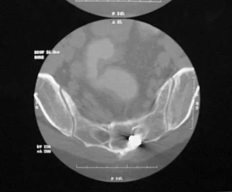 Spine Surgery 2000 Practice Questions: Set 1 (Solved) - Figure 17
