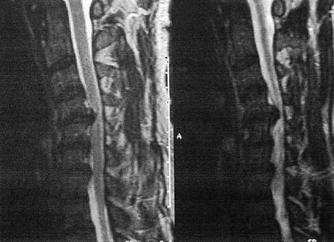 Spine Surgery 2000 Practice Questions: Set 1 (Solved) - Figure 21
