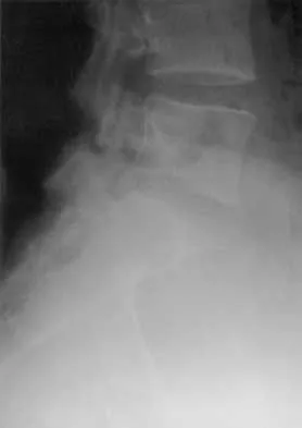 Spine Surgery 2000 Practice Questions: Set 1 (Solved) - Figure 39