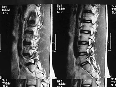 Spine Surgery Board Review 2000: High-Yield MCQs (Set 2) - Figure 10