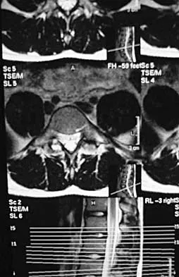 Spine Surgery Board Review 2000: High-Yield MCQs (Set 2) - Figure 13