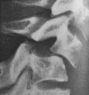Spine Surgery Board Review 2000: High-Yield MCQs (Set 2) - Figure 2