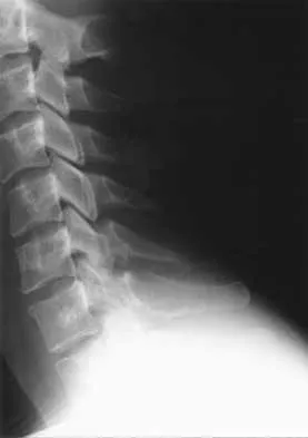 Spine Surgery Board Review 2000: High-Yield MCQs (Set 2) - Figure 24