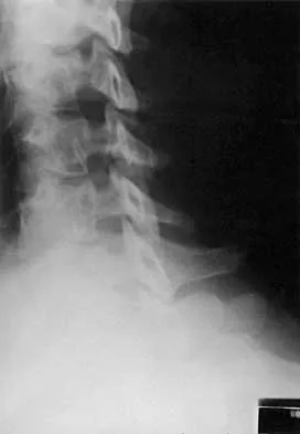 Spine Surgery Board Review 2000: High-Yield MCQs (Set 2) - Figure 25