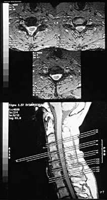 Spine Surgery Board Review 2000: High-Yield MCQs (Set 2) - Figure 29