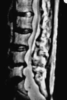 Spine Surgery Board Review 2000: High-Yield MCQs (Set 2) - Figure 8