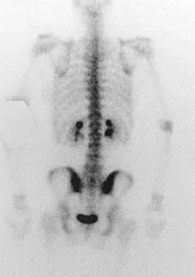 Spine Surgery 2000 Practice Questions: Set 3 (Solved) - Figure 14