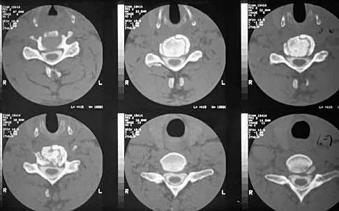 Spine Surgery 2000 Practice Questions: Set 3 (Solved) - Figure 16
