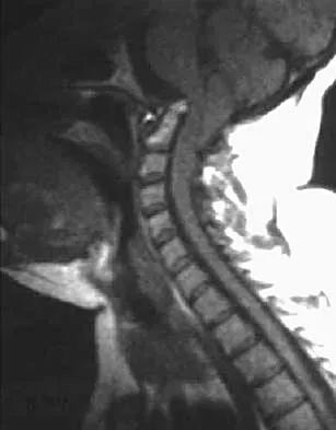 Spine Surgery 2000 Practice Questions: Set 3 (Solved) - Figure 6