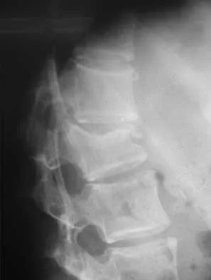Spine Surgery 2000 Practice Questions: Set 3 (Solved) - Figure 8