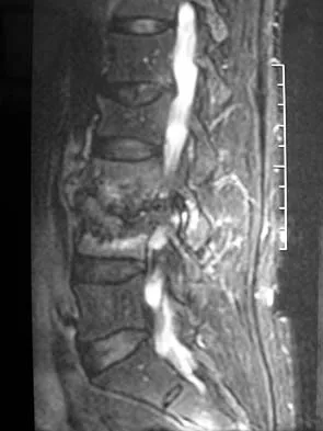 Spine 2006 MCQs - Part 1