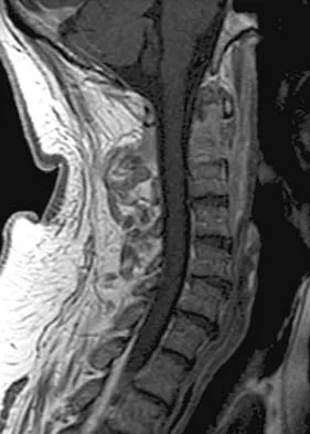 Spine Surgery 2006 Practice Questions: Set 1 (Solved) - Figure 13