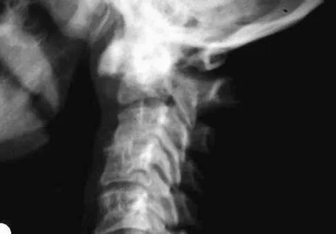 Spine Surgery 2006 Practice Questions: Set 1 (Solved) - Figure 17