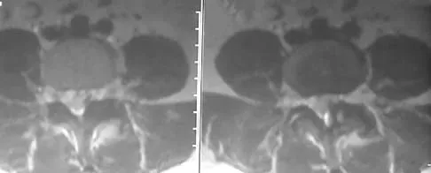 Spine Surgery 2006 Practice Questions: Set 1 (Solved) - Figure 18