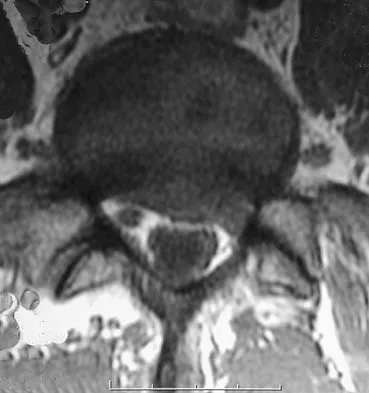 Spine Surgery 2006 Practice Questions: Set 1 (Solved) - Figure 27