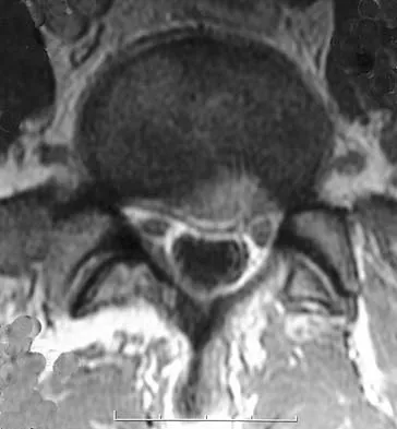 Spine Surgery 2006 Practice Questions: Set 1 (Solved) - Figure 28