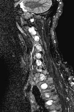 Spine Surgery 2006 Practice Questions: Set 1 (Solved) - Figure 4