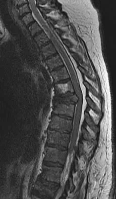 Spine Surgery Board Review 2006: High-Yield MCQs (Set 2) - Figure 1