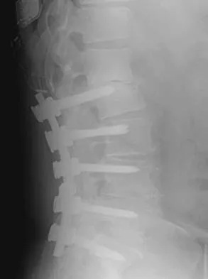 Spine Surgery Board Review 2006: High-Yield MCQs (Set 2) - Figure 11