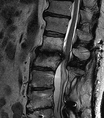 Spine Surgery Board Review 2006: High-Yield MCQs (Set 2) - Figure 12