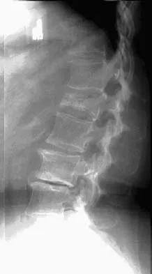 Spine Surgery Board Review 2006: High-Yield MCQs (Set 2) - Figure 7
