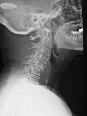 Spine Surgery 2006 Practice Questions: Set 3 (Solved) - Figure 12