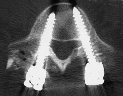Spine Surgery 2006 Practice Questions: Set 3 (Solved) - Figure 14