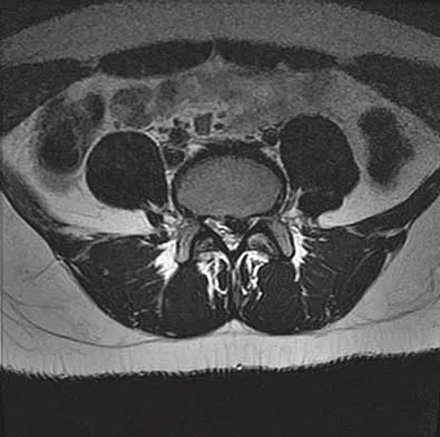 Spine Surgery 2006 Practice Questions: Set 3 (Solved) - Figure 6