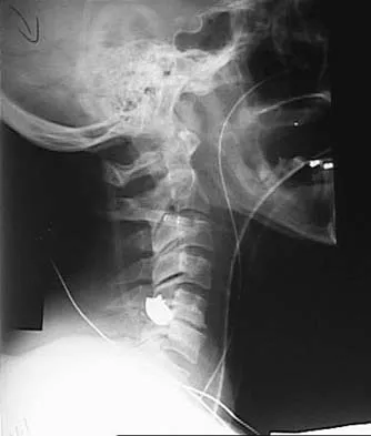 Spine Surgery 2006 Practice Questions: Set 3 (Solved) - Figure 7