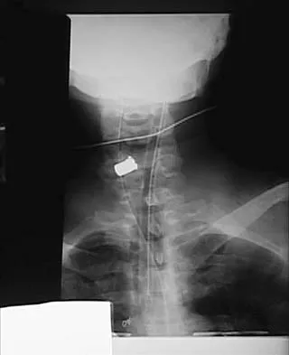 Spine Surgery 2006 Practice Questions: Set 3 (Solved) - Figure 8