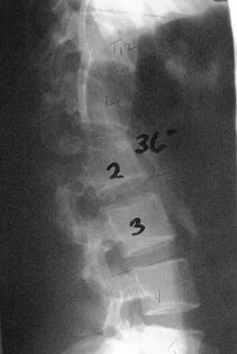 Spine Surgery Board Review 2006: High-Yield MCQs (Set 4) - Figure 3