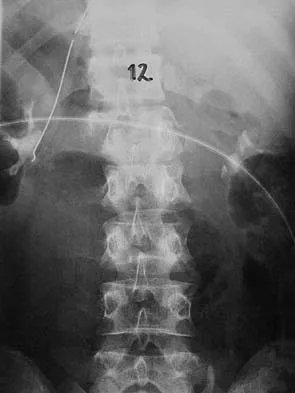 Spine Surgery Board Review 2006: High-Yield MCQs (Set 4) - Figure 6
