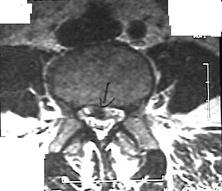 Spine Surgery Board Review 2006: High-Yield MCQs (Set 4) - Figure 8