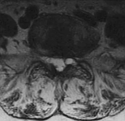 Spine Surgery 2009 Practice Questions: Set 1 (Solved) - Figure 15