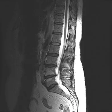Spine Surgery 2009 Practice Questions: Set 1 (Solved) - Figure 17