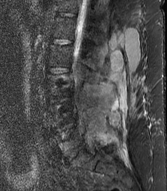 Spine Surgery 2009 Practice Questions: Set 1 (Solved) - Figure 2