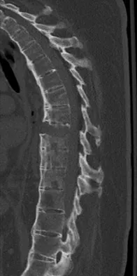 Spine Surgery 2009 Practice Questions: Set 1 (Solved) - Figure 25