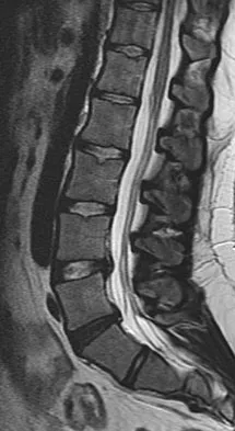 Spine Surgery 2009 Practice Questions: Set 1 (Solved) - Figure 27