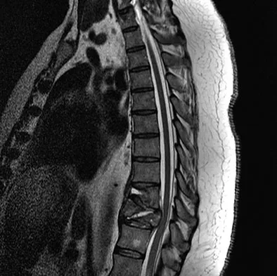 Spine Surgery 2009 Practice Questions: Set 1 (Solved) - Figure 28