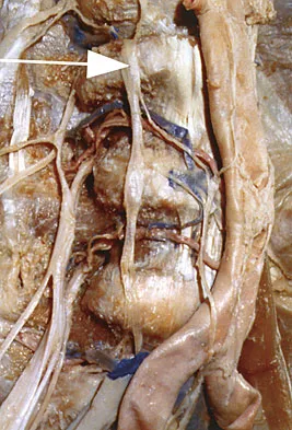 Spine Surgery 2009 Practice Questions: Set 1 (Solved) - Figure 32