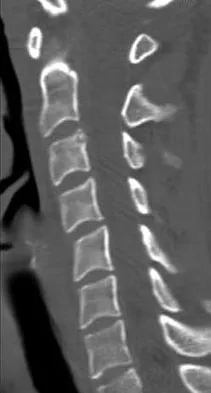 Spine Surgery 2009 Practice Questions: Set 1 (Solved) - Figure 7