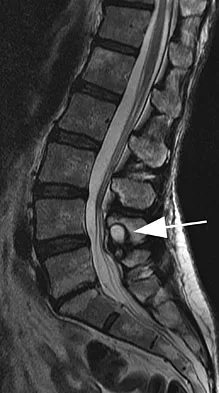Spine Surgery Board Review 2009: High-Yield MCQs (Set 2) - Figure 10