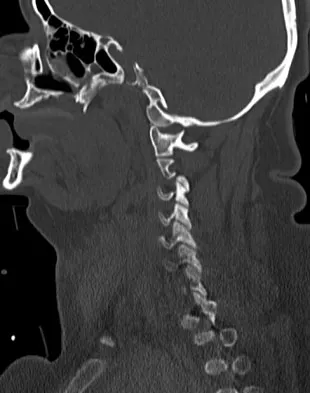 Spine Surgery Board Review 2009: High-Yield MCQs (Set 2) - Figure 14