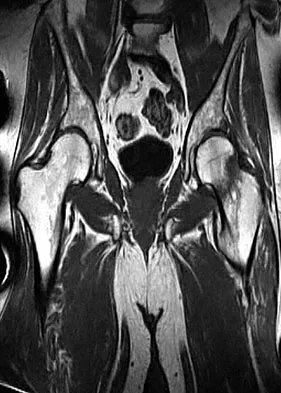 Spine Surgery Board Review 2009: High-Yield MCQs (Set 2) - Figure 22