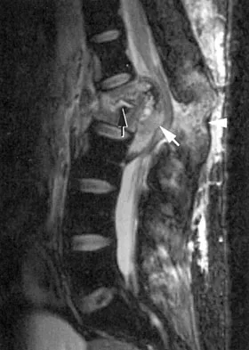 Spine Surgery Board Review 2009: High-Yield MCQs (Set 2) - Figure 25