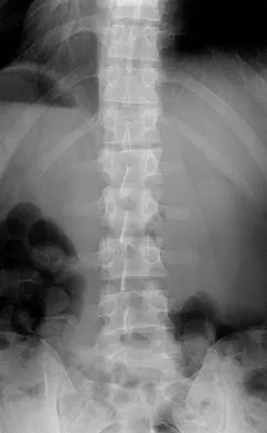 Spine Surgery Board Review 2009: High-Yield MCQs (Set 2) - Figure 30
