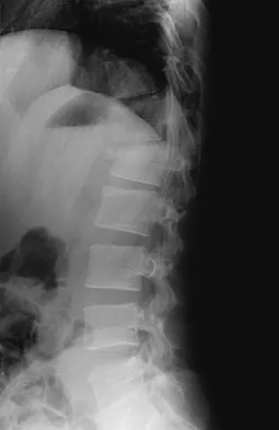 Spine Surgery Board Review 2009: High-Yield MCQs (Set 2) - Figure 31
