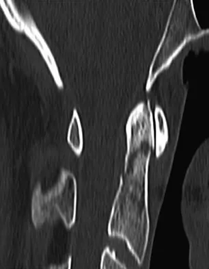 Spine Surgery Board Review 2009: High-Yield MCQs (Set 2) - Figure 5