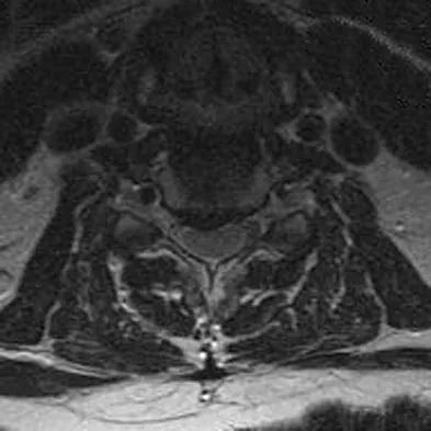 Spine Surgery 2009 Practice Questions: Set 3 (Solved) - Figure 10